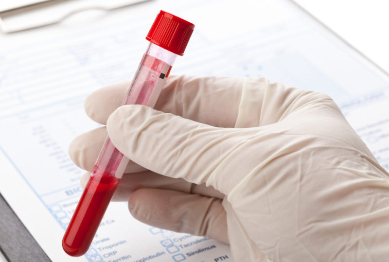 Blood sample 800x539 1